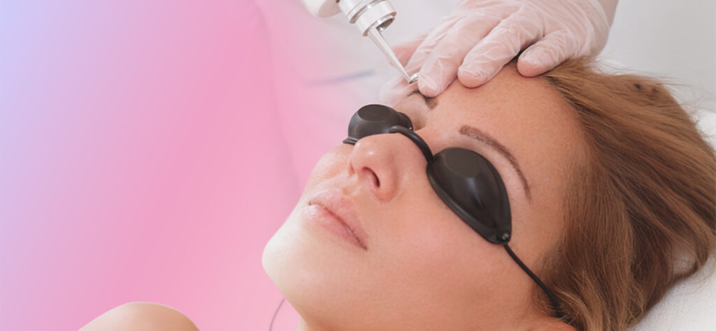 What Is Laser Tattoo Removal?